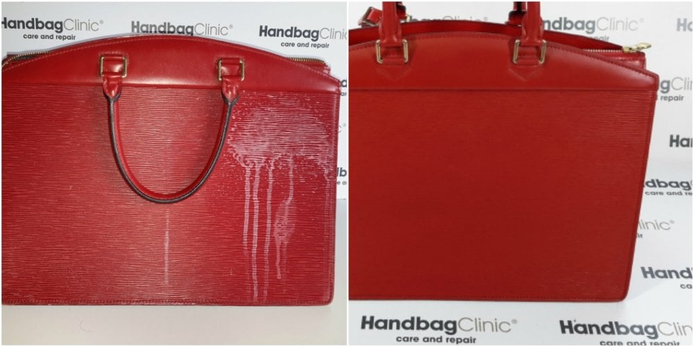 Handbag Cleaning & Stain Removal by Handbag Clinic